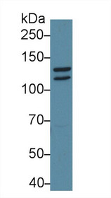 Western Blot; Sample: Mouse Cerebrum lysate; Primary Ab: 1µg/ml Rabbit Anti-Mouse STAT2 Antibody Second Ab: 0.2µg/mL HRP-Linked Caprine Anti-Rabbit IgG Polyclonal Antibody
