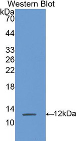 Western Blot; Sample: Recombinant protein.