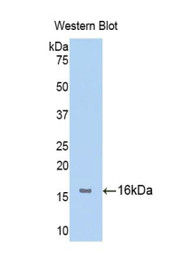 Western Blot; Sample: Recombinant protein.