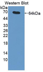 Western Blot; Sample: Recombinant protein.