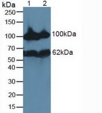 Western Blot; Lane1: Rat Kidney Tissue; Lane2: Mouse Kidney Tissue.