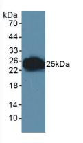 Western Blot; Sample: Human Lymphocyte Cells.