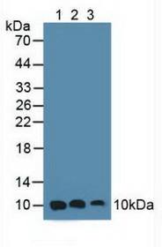 Western Blot; Sample: Lane1: Human Hela Cells; Lane2: Human A549 Cells; Lane3: Human MCF7 Cells.
