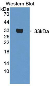 Western Blot; Sample: Recombinant protein.
