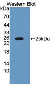 Western Blot; Sample: Recombinant protein.