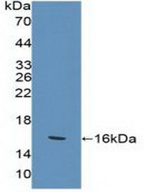 Western Blot; Sample: Recombinant KLRK1, Human.