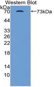 Western Blot; Sample: Recombinant protein.