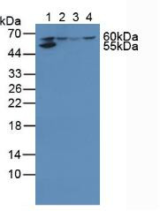 Western Blot; Sample: Lane1: Human Liver Tissue; Lane2: Human 293T Cells; Lane3: Human HepG2 Cells; Lane4: Human Jurkat Cells.