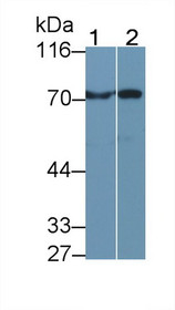 Western Blot; Sample: Recombinant protein.