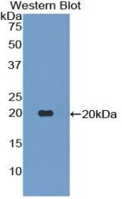 Western Blot; Sample: Recombinant protein.