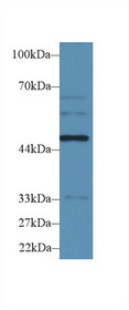 Western Blot; Sample: Human HepG2 cell lysate; Primary Ab: 2µg/ml Rabbit Anti-Rat WARS Antibody Second Ab: 0.2µg/mL HRP-Linked Caprine Anti-Rabbit IgG Polyclonal Antibody