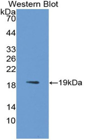 Western Blot; Sample: Recombinant protein.