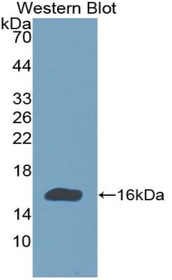 Western Blot; Sample: Recombinant protein.