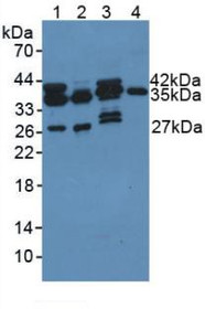 Western Blot; Sample: Lane1: Rat Liver Tissue; Lane2: Rat Lung Tissue; Lane3: Mouse Liver Tissue; Lane4: Human Hela Cells.