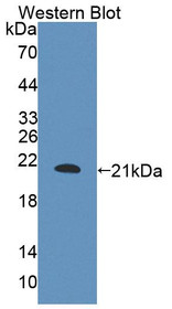 Western Blot; Sample: Recombinant protein.