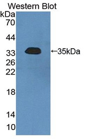 Western Blot; Sample: Recombinant protein.