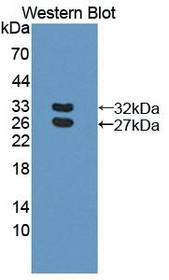 Western Blot; Sample: Recombinant protein.
