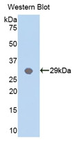 Western Blot; Sample: Recombinant protein.