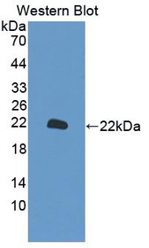 Western Blot; Sample: Recombinant protein.