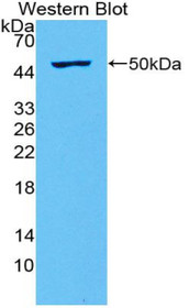Western Blot; Sample: Recombinant protein.
