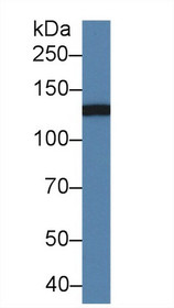 Western Blot; Sample: Mouse Serum; Primary Ab: 2µg/ml Rabbit Anti-Mouse ITGaM Antibody Second Ab: 0.2µg/mL HRP-Linked Caprine Anti-Rabbit IgG Polyclonal Antibody