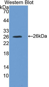 Western Blot; Sample: Recombinant protein.