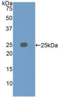 Western Blot; Sample: Recombinant IGFBP7, Rat.