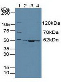 Western Blot; Sample: Lane1: Human 293T Cells; Lane2: Human Hela Cells; Lane3: Mouse Skeletal Muscle Tissue; Lane4: Human HepG2 Cells.