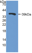 Western Blot Sample: Recombinant TFF3, Porcine