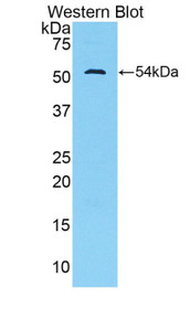 Western Blot; Sample: Recombinant protein.