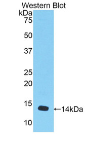 Western Blot; Sample: Recombinant protein.