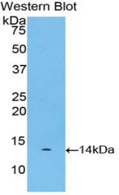 Western Blot; Sample: Recombinant protein.
