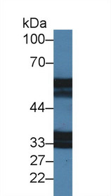 Western Blot; Sample: Mouse Stomach lysate; Primary Ab: 2µg/ml Rabbit Anti-Mouse IL18R1 Antibody Second Ab: 0.2µg/mL HRP-Linked Caprine Anti-Rabbit IgG Polyclonal Antibody