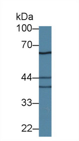 Western Blot; Sample: Mouse Cerebrum lysate; Primary Ab: 1.5µg/ml Rabbit Anti-Mouse IL18R1 Antibody Second Ab: 0.2µg/mL HRP-Linked Caprine Anti-Rabbit IgG Polyclonal Antibody