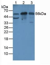 Western Blot; Sample. Lane1: Rat Liver Tissue; Lane2: Mouse Brain Tissue; Lane3: Rat Brain Tissue.