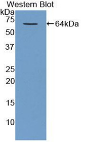 Western Blot; Sample: Recombinant protein.