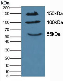 Western Blot; Sample: Mouse Pancreas Tissue.
