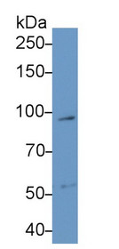 Western Blot; Sample: Recombinant protein.