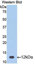 Western Blot; Sample: Recombinant protein.