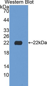 Western Blot; Sample: Recombinant protein.