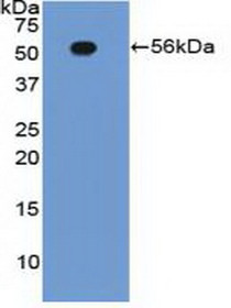 Western Blot; Sample: Recombinant ITGb2, Human.