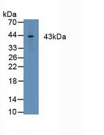 Western Blot; Sample:Human MCF7 Cells.