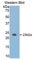 Western Blot; Sample: Recombinant protein.