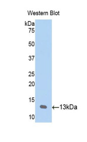 Western Blot; Sample: Recombinant protein.