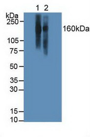 Western Blot; Sample:Lane1: Human Jurkat Cells; Lane2: Human Raji Cells.