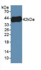 Western Blot; Sample: Recombinant PF4V1, Human.