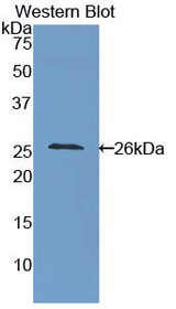 Western Blot; Sample: Recombinant protein.