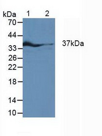 Western Blot; Sample: Lane1: Rat Fetal Rat Tissue; Lane2: Rat Heart Tissue; Lane3: Rat Placenta Tissue.