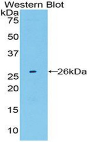 Western Blot; Sample: Recombinant protein.
