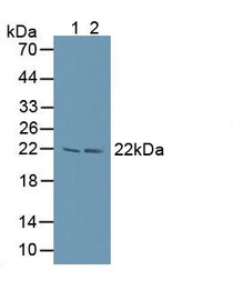 Western Blot; Sample: Lane1: Human Lung Tissue; Lane2: Bovine Lymphocytes Cells.